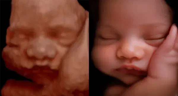 8K realistic baby image 8