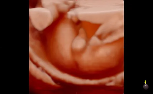 Gender Reveal sample 2