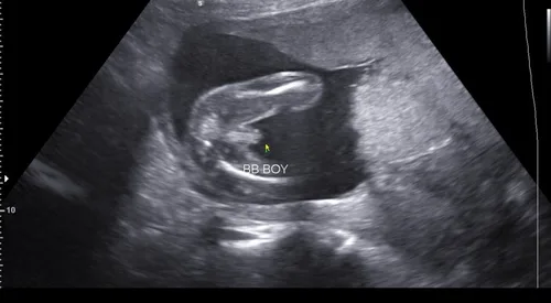 Gender Reveal sample 3