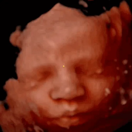 Meet Your Baby sample 1