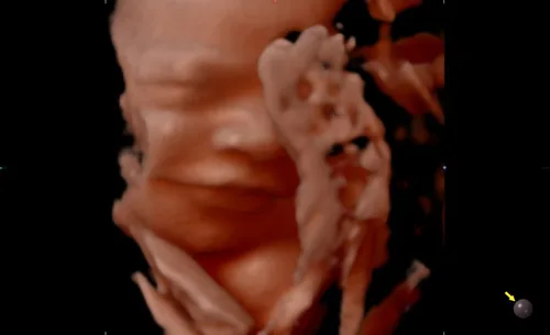 Meet Your Baby sample 2