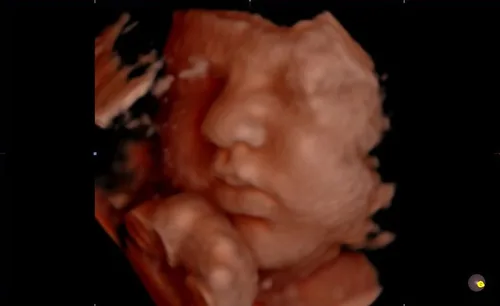 Meet Your Baby sample 3