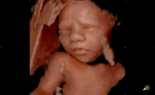 Meet Your Baby sample 4